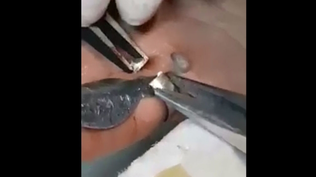 Parmağına yüzük sıkıştı yardımına itfaiye yetişti...