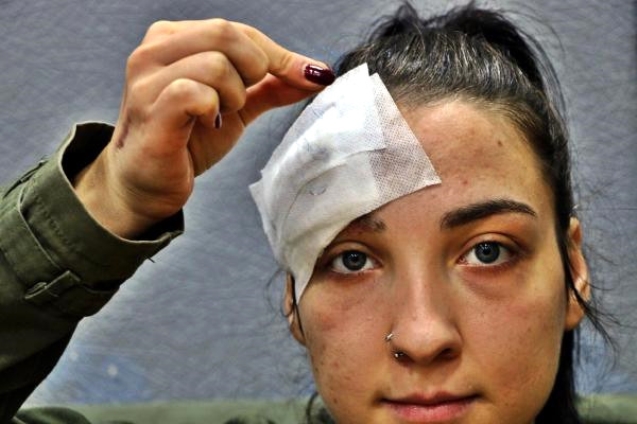 İğne Bilinçli olarak bırakılmış…