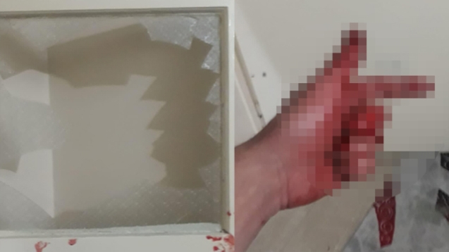 Çocuklarını göremeyince kendine zarar verdi...