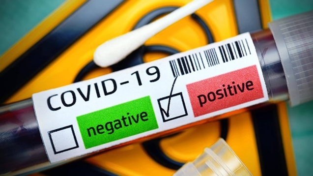 Çocuk Evlerinde 13 personelin testi pozitif çıktı...
